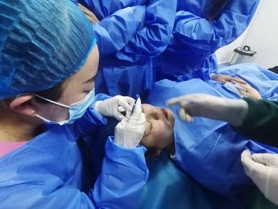 珠海學(xué)微整去哪里